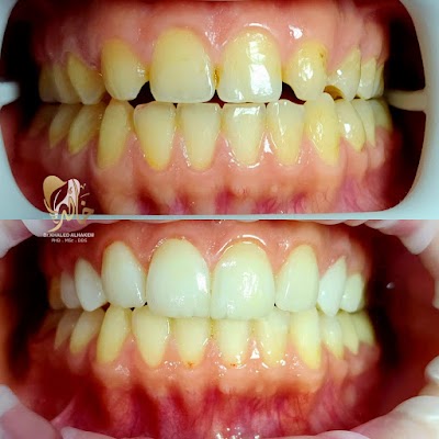 عيادة الدكتور خالد الحكيم لطب وتجميل الأسنان