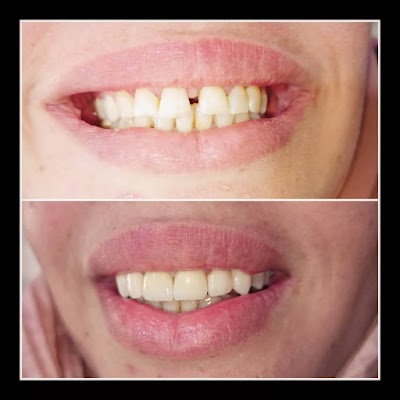 عيادة الدكتور محمد المحاميد لطب الأسنان_beauty smile clinic