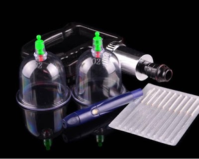 أبودانيال للحجامة والإبرة الصينية