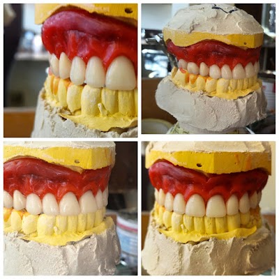 Detective Kalash for dental industry