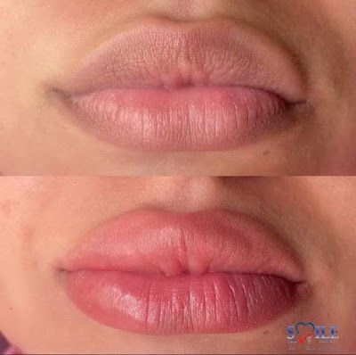 Dr Ali Zayod your smile Clinic