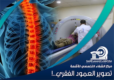 مركز الشفاء التخصصي للأشعة