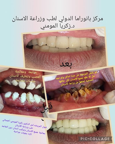 مركز بانوراما الدولي لطب وزراعة الأسنان