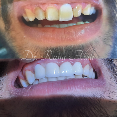Rami Dental Clinic ( الدكتور رامي العلي )